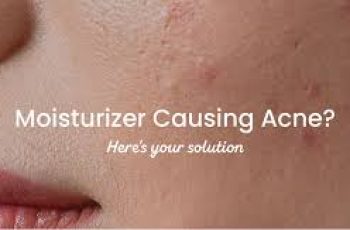 Does Moisturizer Help or Hurt Acne-Prone Skin?