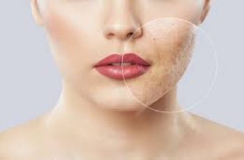 Does Makeup Cause Acne? Here’s How to Prevent Breakouts