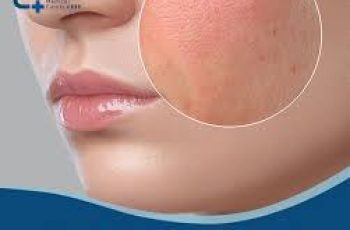 What Really Causes Dry Skin and How to Treat It What Really Causes Dry Skin and How to Treat It