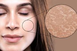 Understanding Dry Skin Types: Find the Right Fix for You