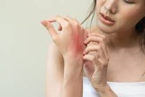 Itchy Skin? Here’s Everything to Know About Eczema