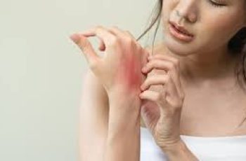 Itchy Skin? Here’s Everything to Know About Eczema Itchy Skin? Here’s Everything to Know About Eczema
