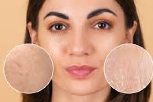 Exfoliation vs. Desquamation: What’s the Difference?