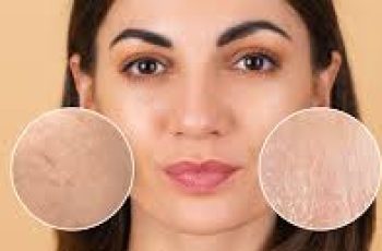 Exfoliation vs. Desquamation: What’s the Difference?