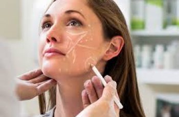 Filler Treatments for Acne Scars: A Complete Skincare Transformation Guide