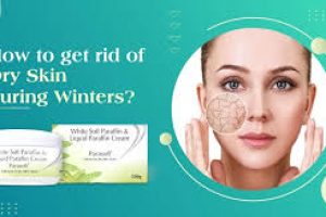 How to Prevent and Treat Dry Skin During Winter Months