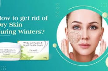 How to Prevent and Treat Dry Skin During Winter Months How to Prevent and Treat Dry Skin During Winter Months