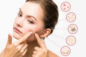 Clearer Skin Guide: Treating Acne and Facial Blemishes Safely