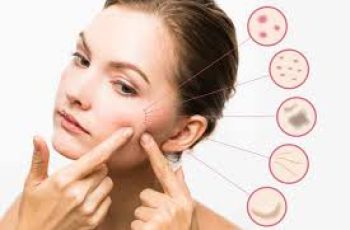 Clearer Skin Guide: Treating Acne and Facial Blemishes Safely