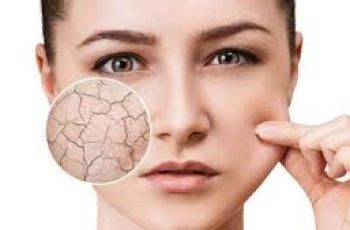 Essential Skincare Tips to Identify and Fix Dehydrated Skin Essential Skincare Tips to Identify and Fix Dehydrated Skin