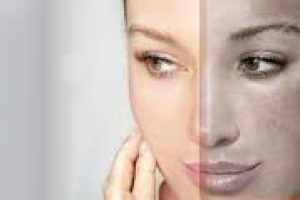 Dermatologist’s Guide to Hydroquinone: Benefits, Safety, and Proper Use