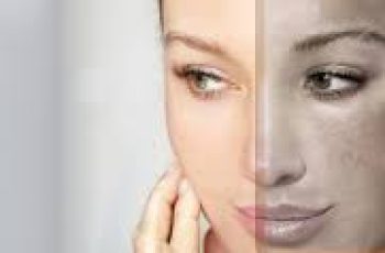 Dermatologist’s Guide to Hydroquinone: Benefits, Safety, and Proper Use