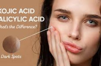 Salicylic Acid for Spots: The Truth About Acne and How It Really Works Salicylic Acid for Spots: The Truth About Acne and How It Really Works