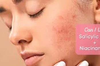 Salicylic Acid, Niacinamide, Hyaluronic Acid: A Perfect Skincare Trio