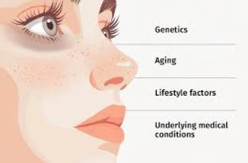 Dark Circles Explained: Causes and Skin Care Solutions That Work