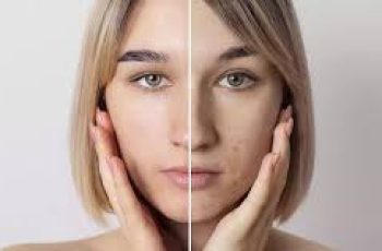 Understanding Skin Renewal: Desquamation vs. Exfoliation in Skincare Understanding Skin Renewal: Desquamation vs. Exfoliation in Skincare