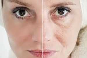 How Glycation Accelerates Skin Aging and Ways to Prevent It