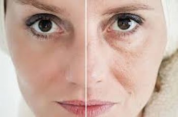 How Glycation Accelerates Skin Aging and Ways to Prevent It How Glycation Accelerates Skin Aging and Ways to Prevent It