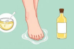 How Glycolic Acid Transforms Dry, Cracked Feet for Sandal Season
