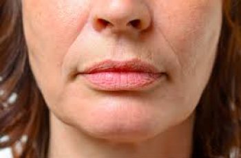 How to Reduce Deep Wrinkles Around Your Mouth Naturally How to Reduce Deep Wrinkles Around Your Mouth Naturally
