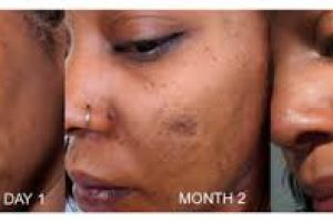 Retinol for Wrinkles: When Skincare Results Actually Appear