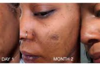 Retinol for Wrinkles: When Skincare Results Actually Appear