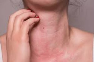 Managing Spring Allergies While Caring for Sensitive Skin