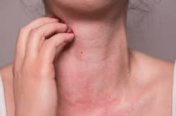 Managing Spring Allergies While Caring for Sensitive Skin