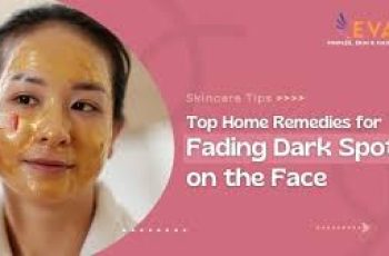 Effective Skincare Guide to Naturally Fade Melasma and Dark Spots