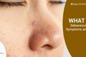 Internal Causes of Oily Skin and How to Control Sebum
