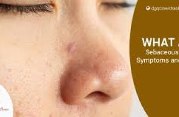 Internal Causes of Oily Skin and How to Control Sebum