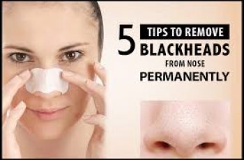 Skincare Guide to Removing and Preventing Blackheads on Your Nose