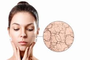 Dry or Dehydrated Skin? How to Tell and Treat It