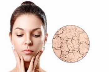 Dry or Dehydrated Skin? How to Tell and Treat It