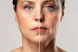 Skincare After Weight Loss: Understanding and Treating Ozempic Face