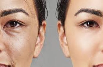 Skincare Science: How Kojic Acid Treats Hyperpigmentation Effectively Skincare Science: How Kojic Acid Treats Hyperpigmentation Effectively