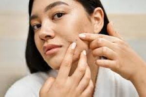 How Dermal Fillers Smooth and Restore Skin After Acne Scarring