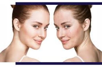 Understanding Fungal Acne and How to Treat Stubborn Skin Breakouts Understanding Fungal Acne and How to Treat Stubborn Skin Breakouts