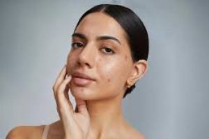 Skincare Guide to Fading Dark Spots on Black Skin Safely