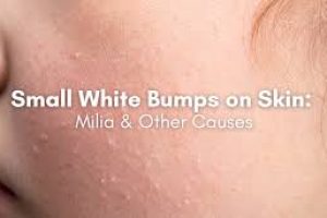 Common Skincare Causes of White Bumps and How to Treat Them