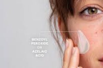 Azelaic Acid vs Benzoyl Peroxide: Skincare Solutions for Acne