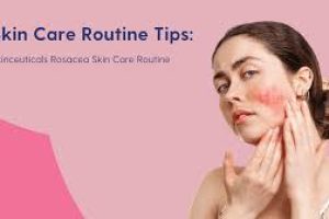 Complete Skincare Guide to Soothing Rosacea and Facial Redness