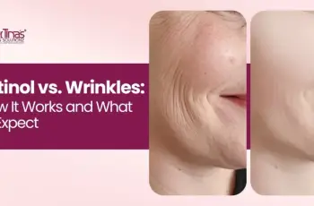 How Long Does Retinol Take To Get Rid Of Wrinkles? How Long Does Retinol Take To Get Rid Of Wrinkles?