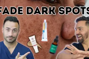 How to Get Rid of Melasma Naturally and Effectively: A Complete Guide to Fading Stubborn Dark Spots