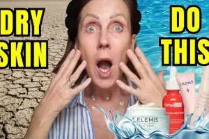 How to Get Rid of Dry Skin in Winter: Your Ultimate Guide to Glowing, Hydrated Skin