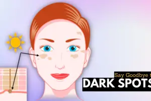 How To Get Rid Of Dark Spots On Black Skin: An Expert-Backed Guide