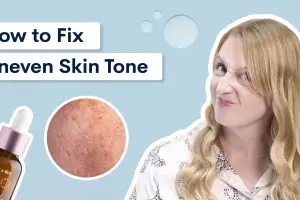 How to Improve Uneven Skin Tone Naturally and Effectively: A Complete Guide to Brighter, Balanced Skin