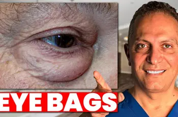 How to Get Rid of Bags Under Your Eyes: Causes, Remedies & Expert Tips How to Get Rid of Bags Under Your Eyes: Causes, Remedies & Expert Tips