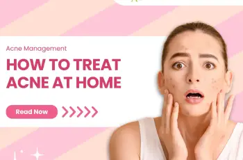 How to Get Rid of Acne: 8 Natural Treatments for Pimples