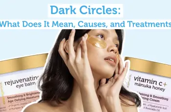 How to Treat Dark Circles – Skincare Routine & Tips
